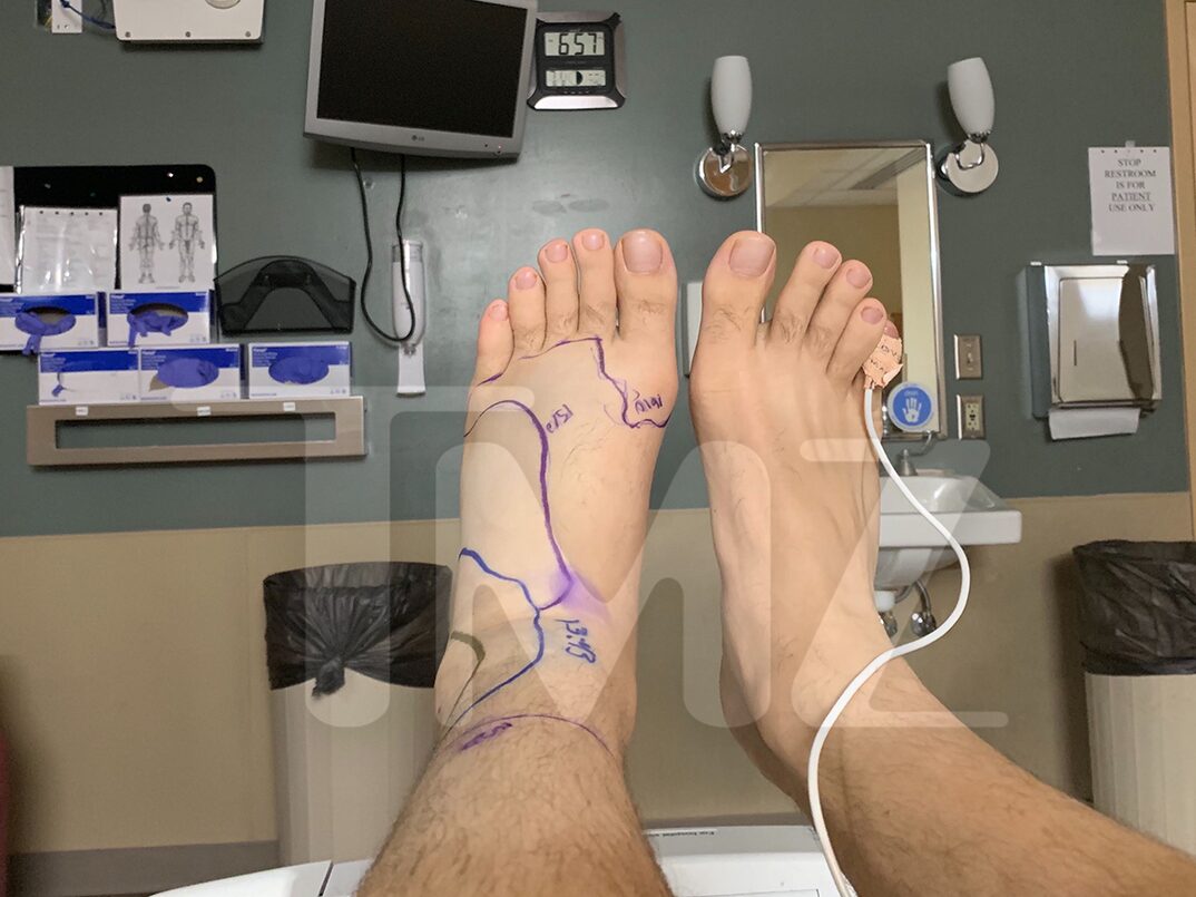 Mike Posner in a hospital in Colorado after a rattlesnake bit his left ankle on August 7, 2019.
